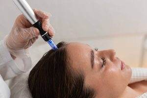 How Do Exosomes Enhance Skin Rejuvenation Therapy?