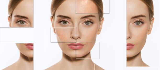 Dry Skin treatment