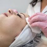 where to get chemical peel