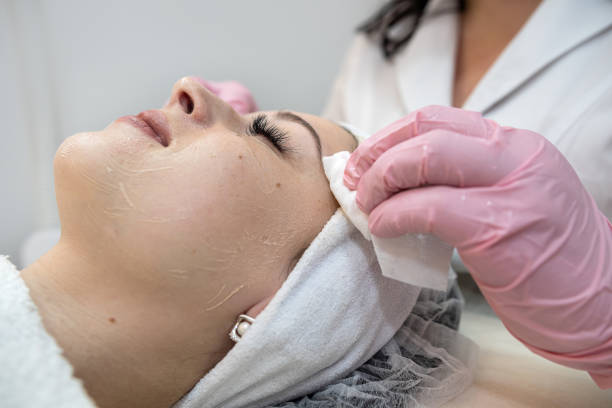 Where Can You Get a Chemical Peel? A Complete Guide for First-Time Patients